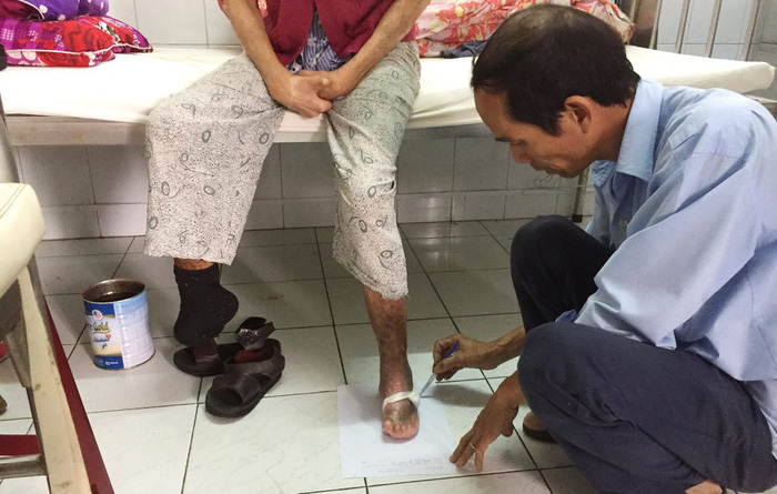 Pham Anh measures a leprosy patient’s foot. Photo: Tuoi Tre