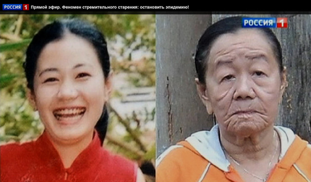 Fast-aging Vietnamese woman on Russian TV show