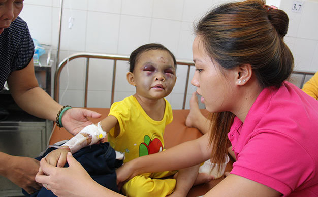 Vietnamese couple detained for brutally beating little daughter