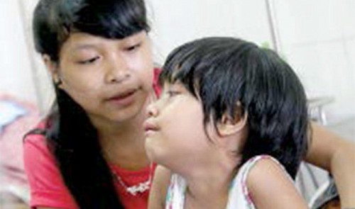 Ethnic Vietnamese teen mothers young sister during blood cancer battle