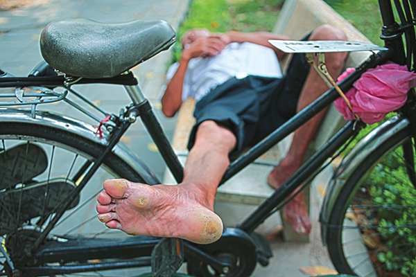 A man tries to keep his bicycle with him while sleeping.