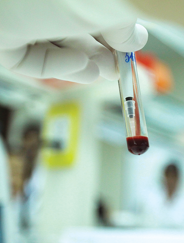 Before a transfusion, a test on the adverse reaction between donated and patient blood will be conducted. If the result is negative, then the transfusion will be performed.