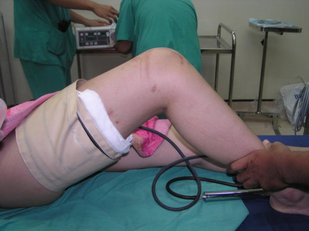 Vietnam doctor faces disciplinary action for wrong-leg surgery