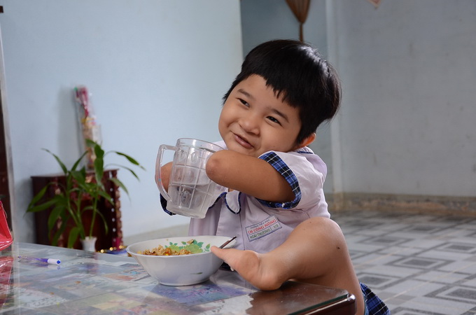 A life full of smile of Vietnamese girl with no arms or legs