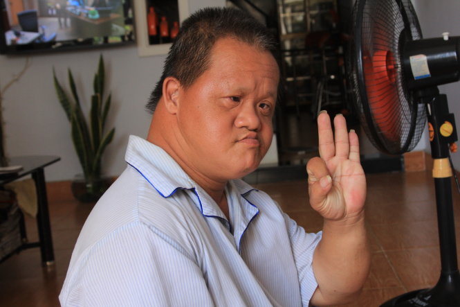 Vietnam’s inspirational waiter overcomes Agent Orange effects