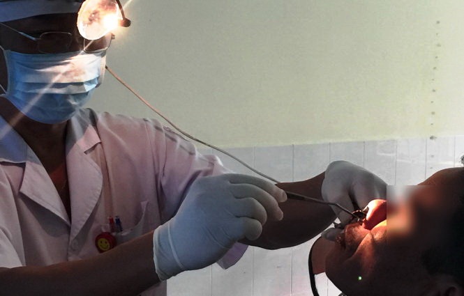 Leech found living in Vietnamese patient’s nose