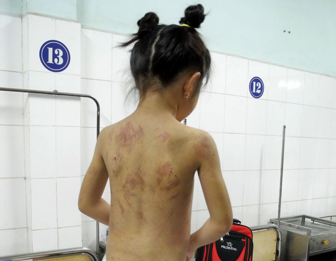 UN vows to purge violence against children in Vietnam