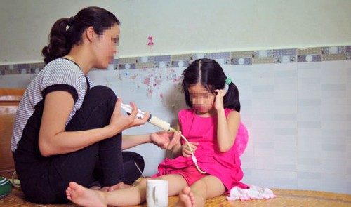 Vietnamese five-year-old suffers esophagitis after drinking bleach