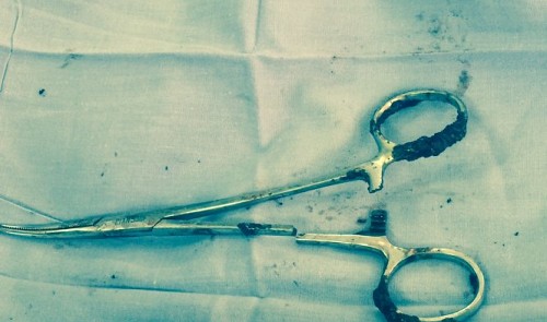 Vietnamese doctors remove pair of scissors colleagues left in patient for 18 years