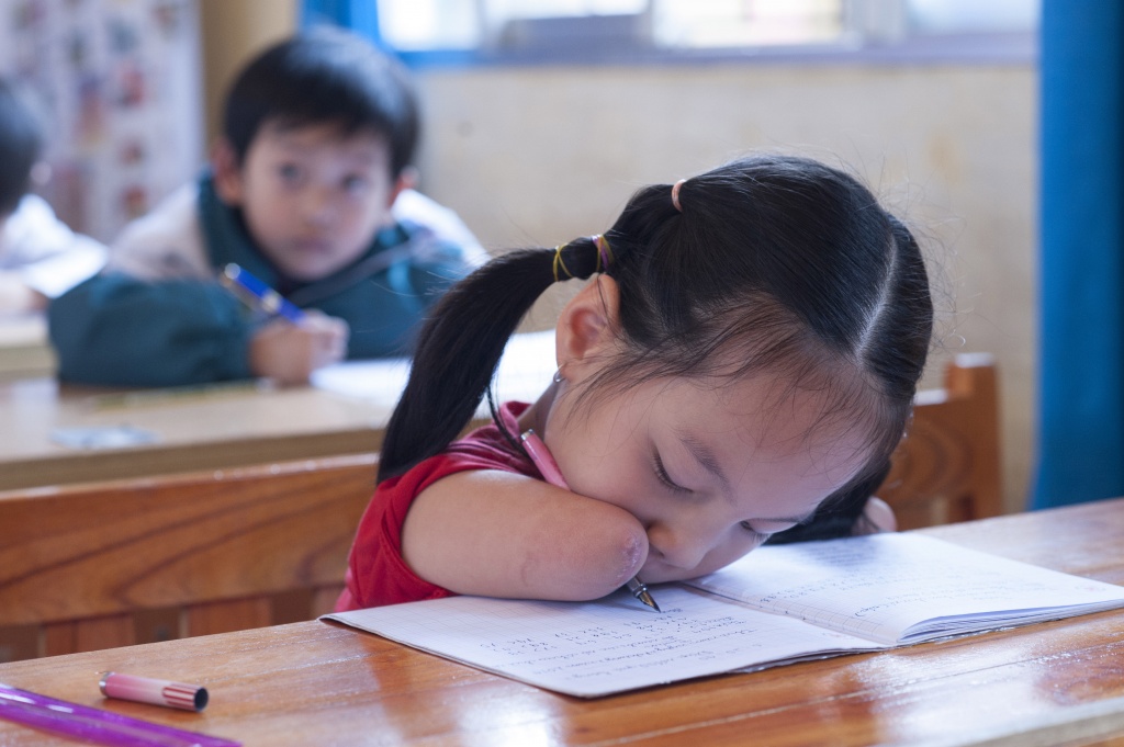 Meet a limbless little girl in Vietnam