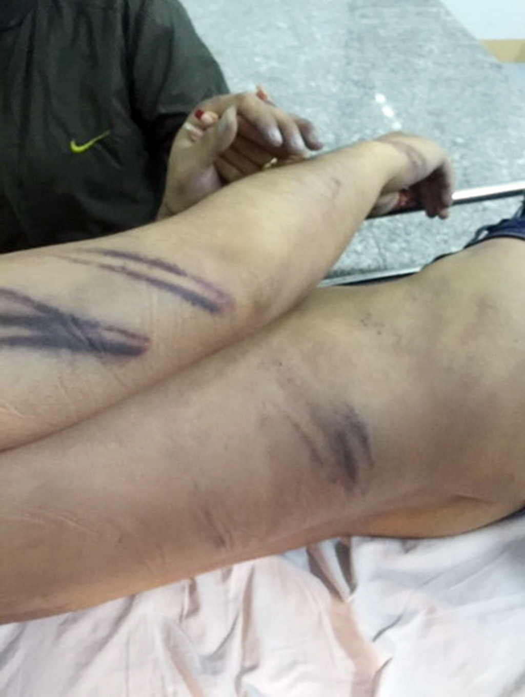 Man dies after alleged corporal punishment by police in Vietnam