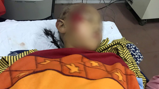 ​11 hospitalized after 2nd floor balcony gives out at school in northern Vietnam