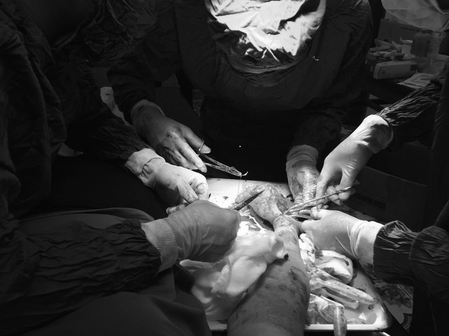 ​Vietnamese doctors reattach woman’s nearly-severed hand 