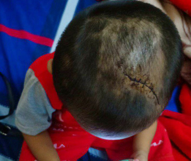 ​Vietnamese police probe stepdad’s abuse of 3-year-old boy