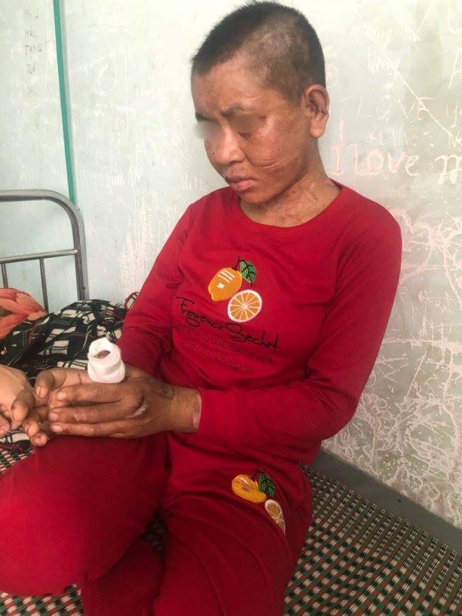 Housemaid brutally tortured, resulting in miscarriage, in Vietnam’s Central Highlands