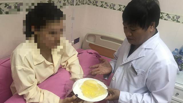 Vietnamese singer reports breast implant bursting mid-flight