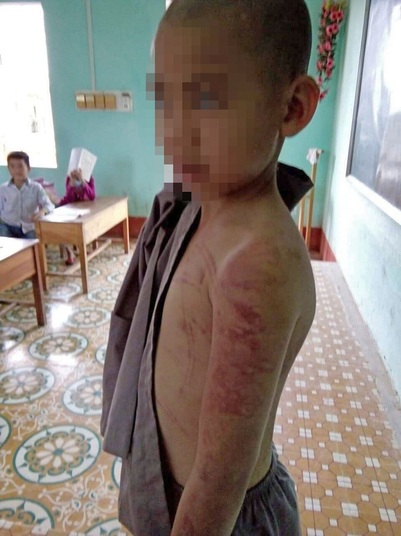 10-yo boy allegedly beaten by abbot in north-central Vietnam