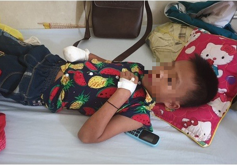9-yo Vietnamese boy loses hand in flashlight explosion