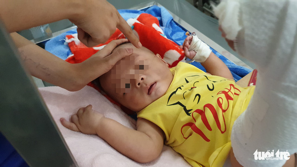 Vietnamese infant hospitalized with serious injuries after babysat by father