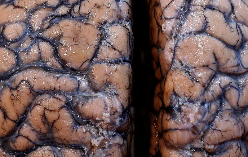 Scientists warn of potential wave of COVID-linked brain damage