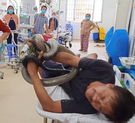 Vietnamese man hospitalized with king cobra still attached to arm