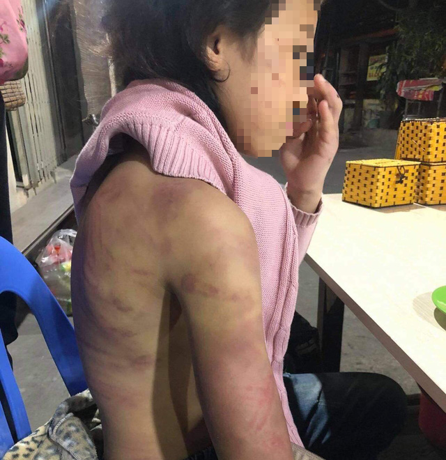 12-year-old girl allegedly tortured by mother, raped by latter’s boyfriend in Hanoi