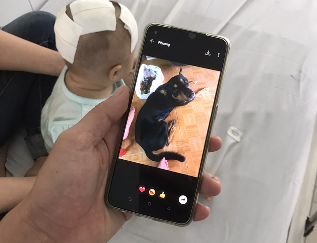 Ho Chi Minh City doctors save 6-month-old girl bitten in head by pet dog