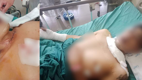 Kite string cuts motorbike rider's throat in Ho Chi Minh City