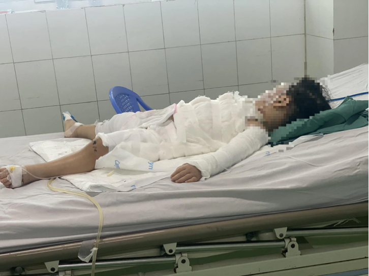 2-year-old boy burned after drinking toilet cleaning solution in Da Nang