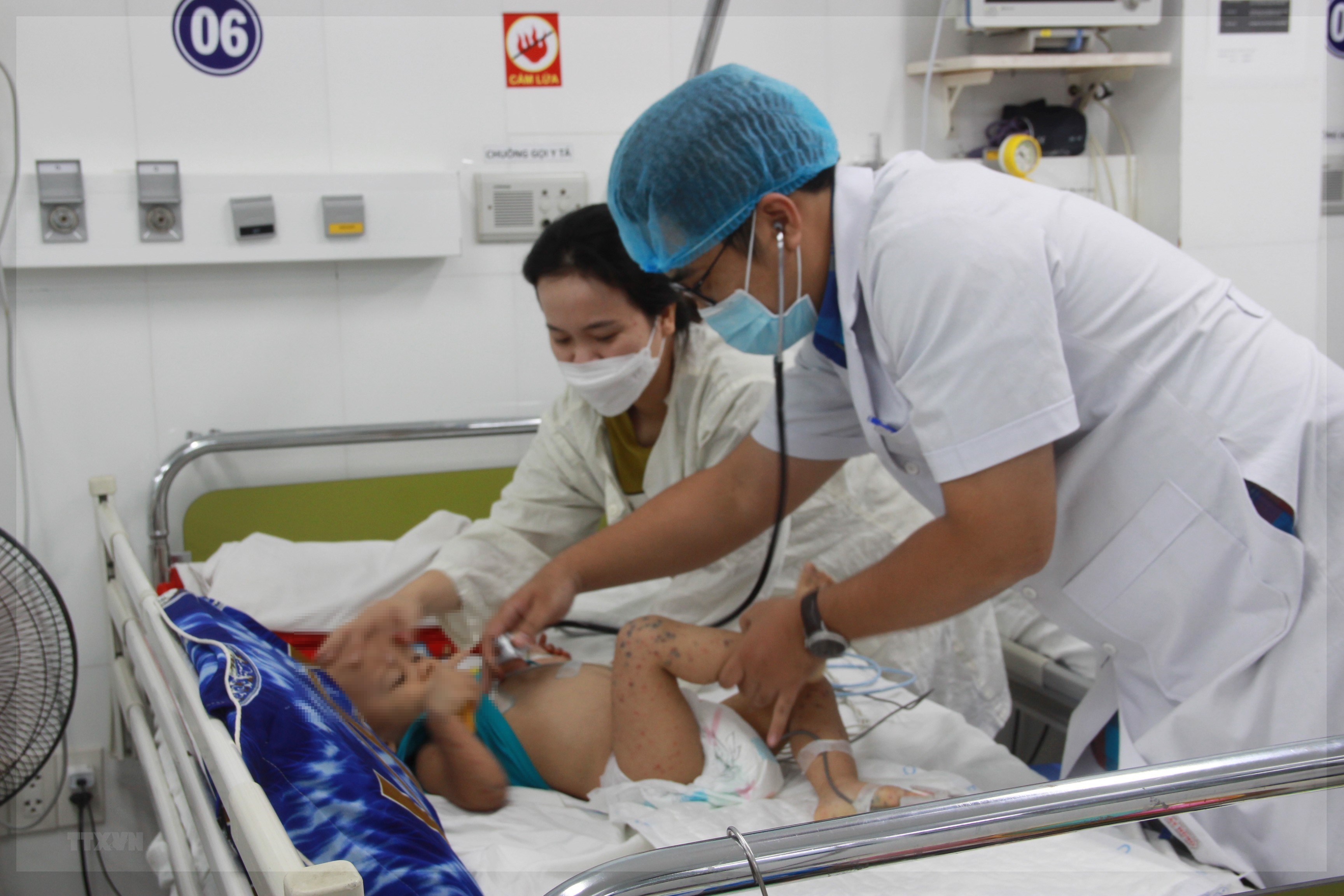 Vietnam logs over 68,000 HFMD cases in year to date: health ministry