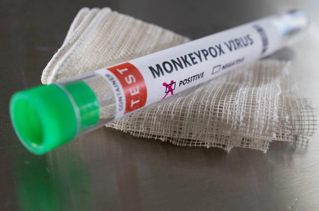 1 more monkeypox case reported in Ho Chi Minh City