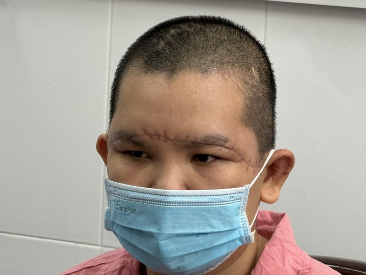 The patient’s scalp has recovered spectacularly. Photo: Thu Hien / Tuoi Tre