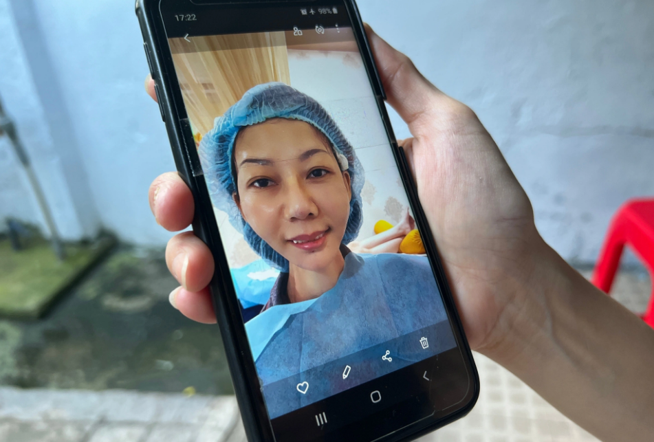 Thanh Tra shows a photo of her face after undergoing a surgery. Photo: Yen Trinh / Tuoi Tre