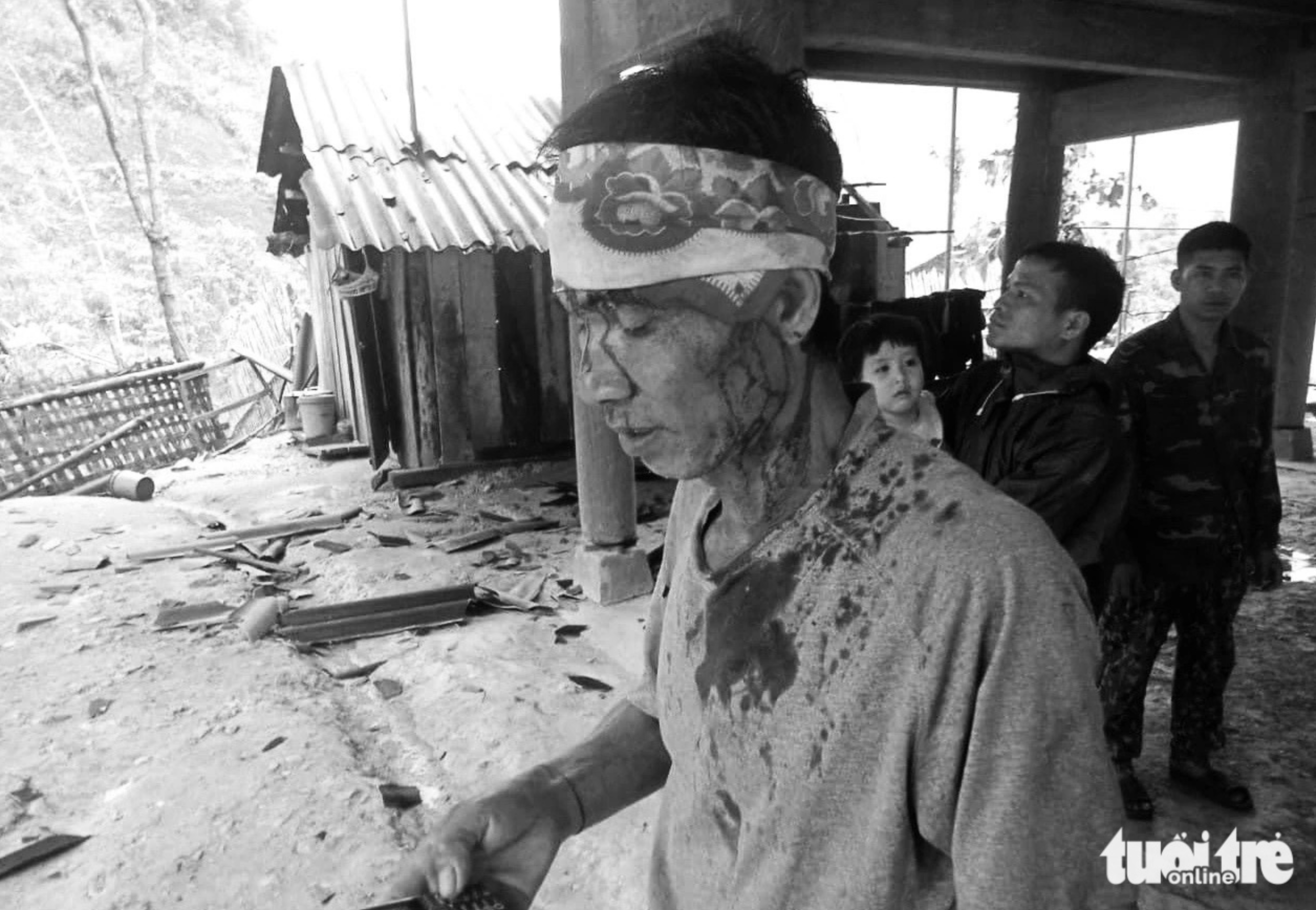 Oc Pho Thang, a resident of Bao Thang Commune under Ky Son District, Nghe An suffers injuries to his head after being hit by a tile during a violent thunderstorm on April 14, 2024. Photo: Tam Pham / Tuoi Tre