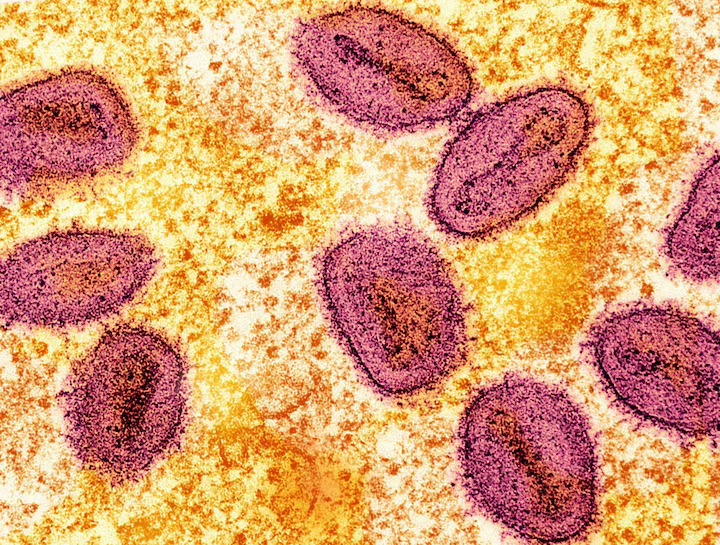 Africa CDC confident it can raise $600 million for mpox response