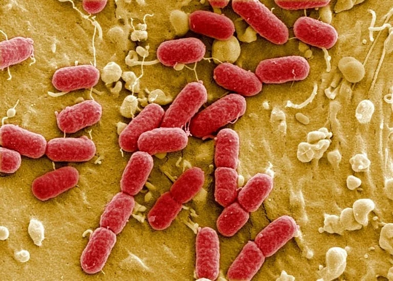 Drug-resistant superbugs projected to kill 39 million by 2050