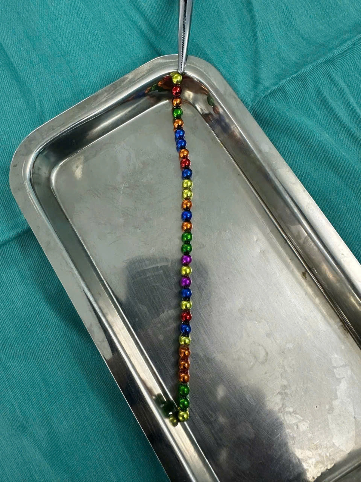 Vietnamese doctors remove 31 magnetic toy balls from small intestine of 3-year-old