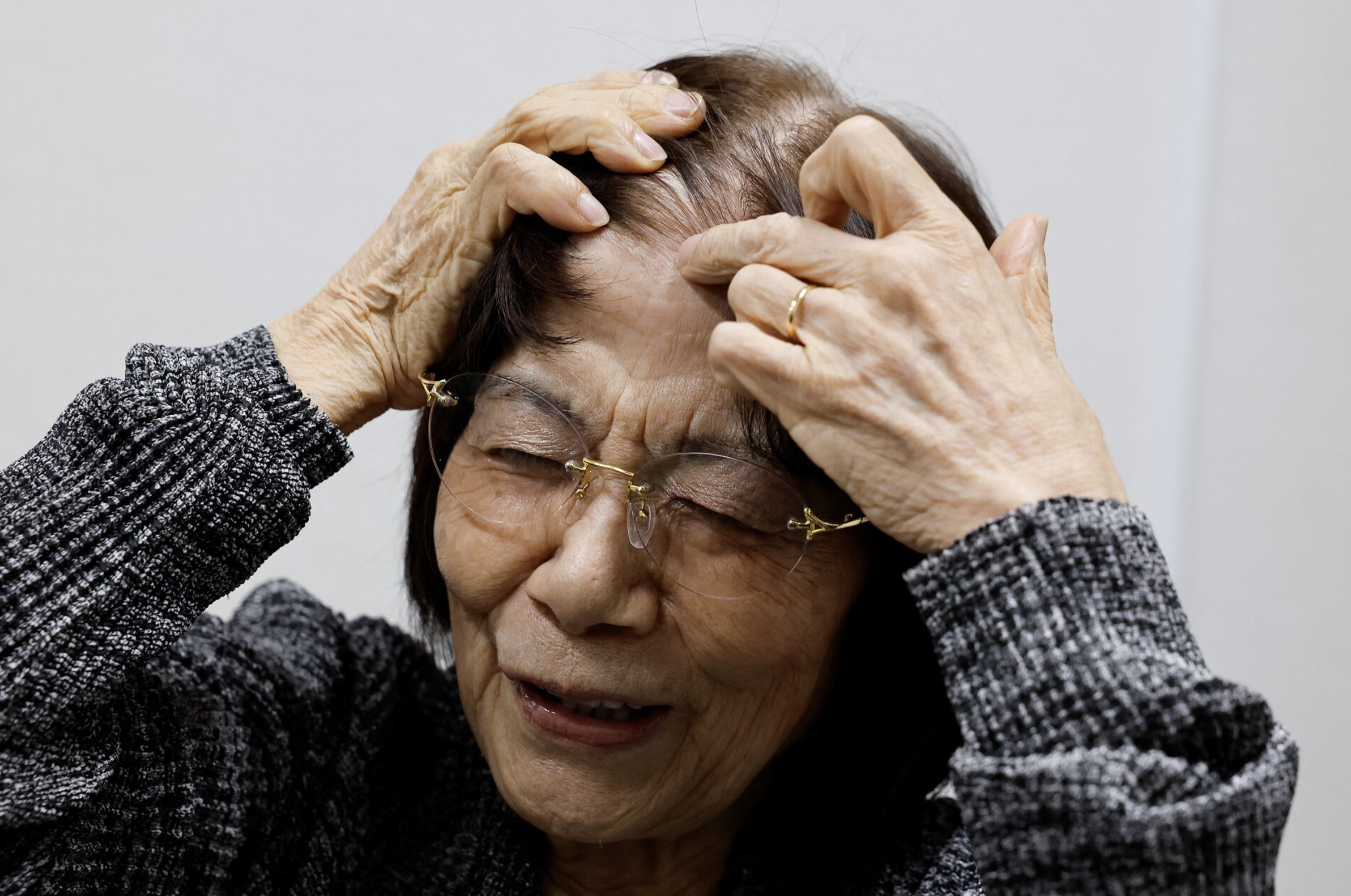 Teruko Yahata, who survived the 1945 atomic bombing of Hiroshima, shows a scar, as she speaks at an interview with Reuters on the following day of The Japan Confederation of A- and H-Bomb Sufferers Organizations (Nihon Hidankyo) winning the 2024 Nobel Peace Prize, in Hiroshima, Japan, October 12, 2024. Photo: Reuters